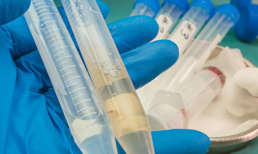 Criança de 7 anos é diagnosticada com meningite em Cruzeiro do Sul