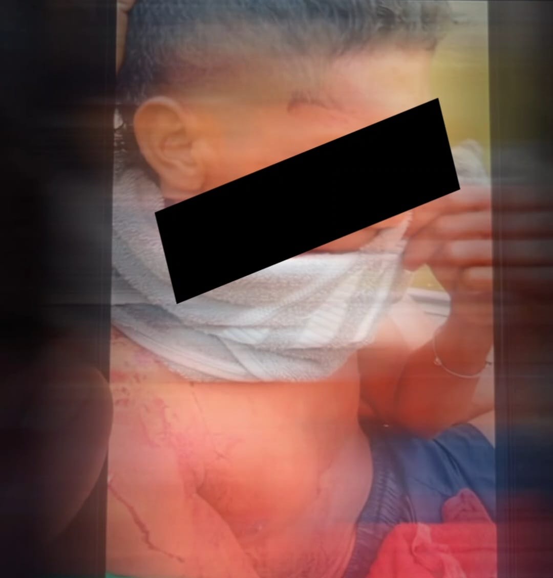 URGENTE: Homem é golpeado com terçado no rosto durante briga no Rio Azul, em Mâncio Lima