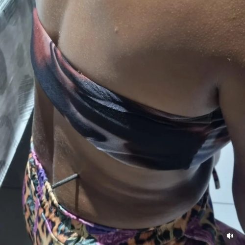 Homem crava Ferramenta na lombar da esposa em Guajará, no Amazonas