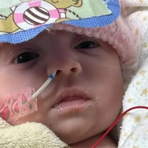 Rifa solidária busca ajudar bebê que sofreu queimaduras em maternidade de Cruzeiro do Sul