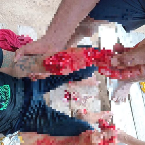 Homem tem dedos decepado durante briga na zona rural de Tarauacá