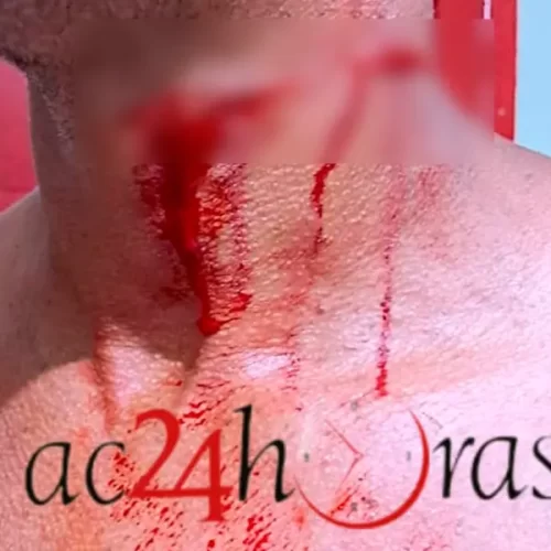 Homem tem pescoço cortado por linha com cerol e por pouco não morre em Epitaciolândia