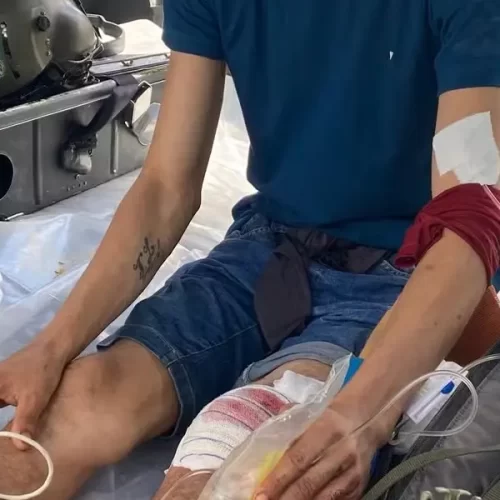 Garimpeiro ferido é resgatado pela Força Nacional na Terra Yanomami