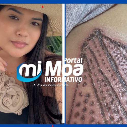 Vanessa Holanda de Mâncio Lima denuncia queimaduras e cicatrizes após procedimento com jato de plasma