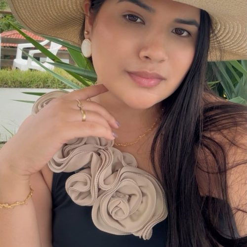 Após a divulgação feita pelo Portal Moa Informativo do caso de procedimento estético que deixou Vanessa Holanda com queimaduras e cicatrizes em Mâncio Lima, Vanessa ganha apoio nas redes sociais.