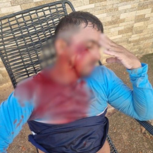 Gari é agredido com pedra no rosto após se recusar a recolher vidro descartado de forma irregular