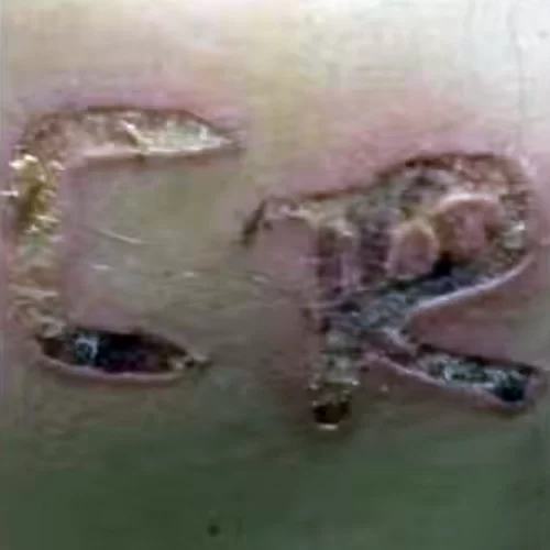 Marido é preso após marcar com ferro quente as iniciais do nome dele no corpo da esposa no interior de SP