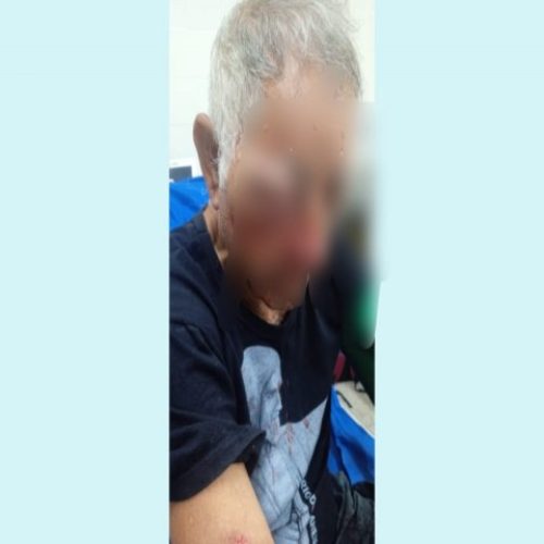 Idoso de Mâncio Lima sofre traumas na cabeça após tombamento de ônibus da Transacreana na BR-364