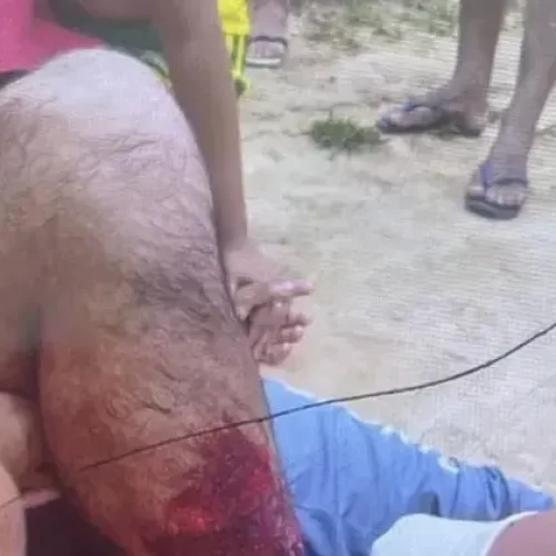 Em Mâncio Lima, indígena é ferido por disparo acidental durante caçada