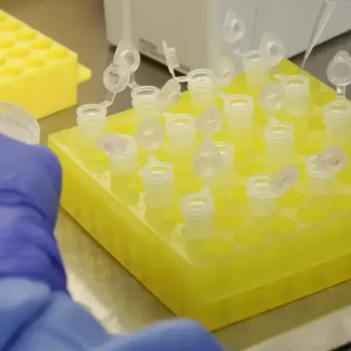 Número de casos suspeitos de sarampo sobe para seis no Acre, informa Sesacre